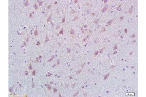 Formalin-fixed and paraffin embedded rat brain labeled with Rabbit Anti STMN2/SCG10 Polyclonal Antibody, Unconjugated  at 1:200 followed by conjugation to the secondary antibody and DAB staining (STMN2 Antikörper  (AA 8-100))