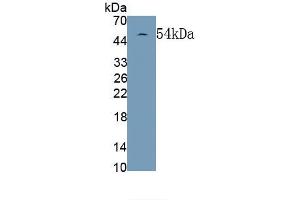 Detection of Recombinant GFAP, Rat using Monoclonal Antibody to Glial Fibrillary Acidic Protein (GFAP) (GFAP Antikörper  (AA 1-430))