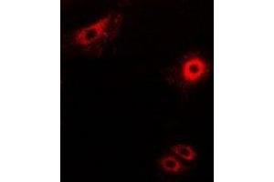 Immunofluorescent analysis of Secretogranin-2 staining in MCF7 cells. (SCG2 Antikörper)