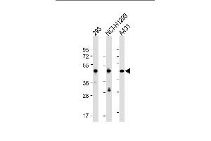 All lanes : Anti-NSFL1C Antibody (N-Term) at 1:2000 dilution Lane 1: 293 whole cell lysate Lane 2: NCI- whole cell lysate Lane 3: A431 whole cell lysate Lysates/proteins at 20 μg per lane. (NSFL1C Antikörper  (AA 37-71))