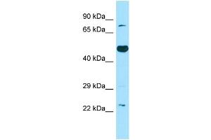 WB Suggested Anti-TBXAS1 Antibody Titration: 1.