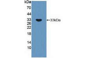 Figure. (RPS6KB1 Antikörper  (AA 91-352))