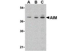 Western Blotting (WB) image for anti-CD5 Molecule-Like (CD5L) (C-Term) antibody (ABIN2472165)