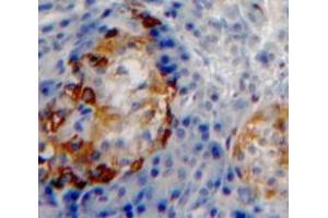 Used in DAB staining on fromalin fixed paraffin-embedded Pancreas tissue (PPY Antikörper  (AA 31-97))