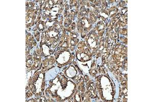 IHC analysis of SDF2L1 using anti-SDF2L1 antibody (ABIN7601111). (SDF2L1 Antikörper  (AA 29-221))