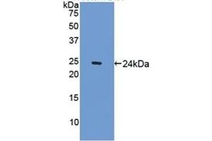 Detection of Recombinant SPRY1, Mouse using Polyclonal Antibody to Sprouty Homolog 1 (SPRY1) (SPRY1 Antikörper  (AA 112-303))