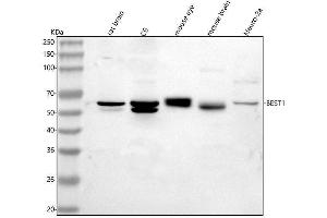 Western blot analysis of Bestrophin-1/Best1 Antibody using anti-Bestrophin-1/Best1 Antibody antibody (ABIN7602635).