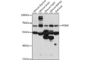 Western blot analysis of extracts of various cell lines, using PGM3 antibody (ABIN7269313) at 1:1000 dilution. (Phosphoglucomutase 3 Antikörper  (AA 1-300))