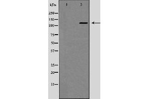 Western blot analysis of JAK1 expression in EGF treated MCF7 whole cell lysates,The lane on the left is treated with the antigen-specific peptide. (JAK1 Antikörper)