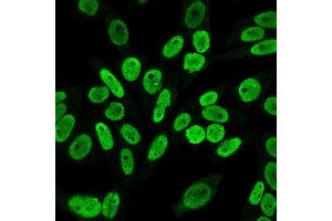 Immunofluorescence Analysis of PFA fixed HeLa cells labeling Cyclin B1 Mouse Monoclonal Antibody (V92. (Cyclin B1 Antikörper)