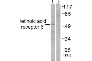 Western Blotting (WB) image for anti-Retinoic Acid Receptor, beta (RARB) (C-Term) antibody (ABIN1848760) (Retinoic Acid Receptor beta Antikörper  (C-Term))
