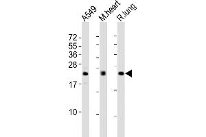 All lanes : Anti-FGF2 Antibody at 1:2000 dilution Lane 1: A549 whole cell lysates Lane 2: mouse heart lysates Lane 3: rat lung lysates Lysates/proteins at 20 μg per lane. (FGF2 Antikörper)