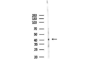 anti-Neuromedin B Receptor (NMBR) (Internal Region) antibody