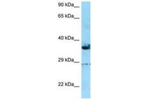 Image no. 1 for anti-Inverted Formin, FH2 and WH2 Domain Containing (INF2) (C-Term) antibody (ABIN6748410) (INF2 Antikörper  (C-Term))