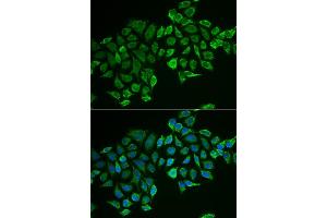 Immunofluorescence analysis of MCF-7 cells using RHOD antibody (ABIN6131344, ABIN6146938, ABIN6146939 and ABIN6222119). (RHOD Antikörper  (AA 1-210))