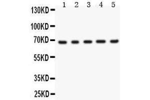 Anti- Menin Picoband antibody, Western blotting All lanes: Anti Menin  at 0. (Menin Antikörper  (AA 301-615))