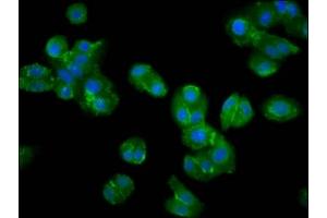 Immunofluorescence staining of HepG2 cells with ABIN7169218 at 1:200, counter-stained with DAPI. (VRK2 Antikörper  (AA 317-472))