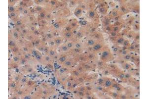 IHC-P analysis of Human Liver Tissue, with DAB staining. (CPB2 Antikörper  (AA 138-423))
