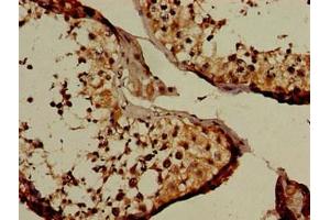 Immunohistochemistry of paraffin-embedded human testis tissue using ABIN7161815 at dilution of 1:100 (NUP107 Antikörper  (AA 1-66))
