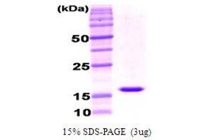 Figure annotation denotes ug of protein loaded and % gel used. (Adiponectin (ADIPOQ) (AA 111-247), (Globular Domain) Peptid)