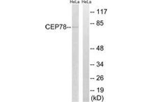 Western blot analysis of extracts from HeLa cells, using CEP78 Antibody. (CEP78 Antikörper  (AA 301-350))