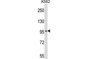 Western Blotting (WB) image for anti-phosphodiesterase 6A, CGMP-Specific, Rod, alpha (PDE6A) antibody (ABIN2997217) (PDE6A Antikörper)