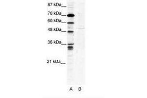 Image no. 1 for anti-Zinc Finger Protein 134 (ZNF134) (AA 93-142) antibody (ABIN202498) (ZNF134 Antikörper  (AA 93-142))