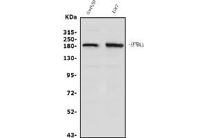 Western blot analysis of SET1/SETD1A using anti-SET1/SETD1A antibody (ABIN7602469).