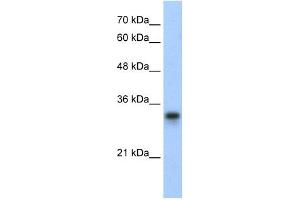 WB Suggested Anti-RPL8 Antibody Titration:  0. (RPL8 Antikörper  (C-Term))