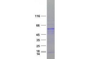 RBM9 Protein (Transcript Variant 1) (Myc-DYKDDDDK Tag)