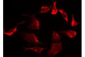 ABIN6267266 staining SK-OV3 by IF/ICC.