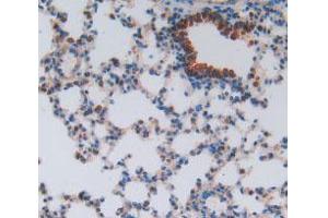 IHC-P analysis of Mouse Lung Tissue, with DAB staining. (HEXB Antikörper  (AA 101-217))
