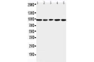 Anti-MCM6 antibody, Western blotting Lane 1: U87 Cell Lysate Lane 2: COLO320 Cell Lysate Lane 3: HELA Cell Lysate Lane 4: MCF-7 Cell Lysate Lane 5: JURKAT Cell Lysate (MCM6 Antikörper  (Middle Region))