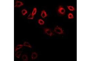 Immunofluorescent analysis of CDK6 staining in K562 cells. (CDK6 Antikörper)