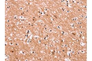 The image on the left is immunohistochemistry of paraffin-embedded Human brain tissue using ABIN7190562(ENPP4 Antibody) at dilution 1/15, on the right is treated with synthetic peptide. (ENPP4 Antikörper)