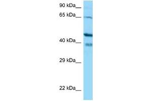 Western Blotting (WB) image for anti-Calcium Binding Protein 1 (CABP1) (N-Term) antibody (ABIN2774384) (CABP1 Antikörper  (N-Term))