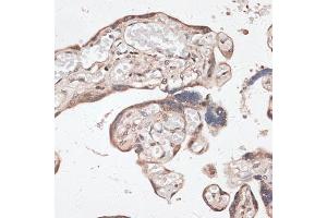 Immunohistochemistry of paraffin-embedded human placenta using SPDEF antibody (ABIN6132572, ABIN6148332, ABIN6148334 and ABIN6218364) at dilution of 1:100 (40x lens). (SPDEF/PSE Antikörper  (AA 1-335))