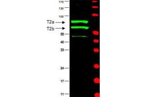 Western blot using CCNT2 polyclonal antibody  is shown to detect two major bands (arrowheads) corresponding to human CCN T2a and T2b as indicated. (Cyclin T2 Antikörper)