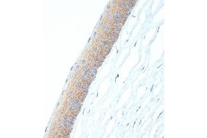 Immunohistochemistry (IHC) image for anti-Cellular Retinoic Acid Binding Protein 1 (CRABP1) antibody (ABIN7266269)