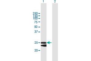 Western Blot analysis of FKBP14 expression in transfected 293T cell line by FKBP14 MaxPab polyclonal antibody.