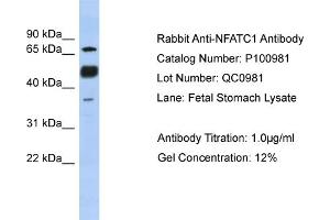 WB Suggested Anti-NFATC1  Antibody Titration: 0. (NFATC1 Antikörper  (N-Term))