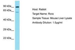 Image no. 1 for anti-RAR-Related Orphan Receptor A (RORA) (AA 201-250) antibody (ABIN6750242) (RORA Antikörper  (AA 201-250))
