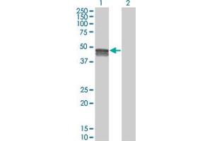 Western Blot analysis of SMPDL3B expression in transfected 293T cell line by SMPDL3B monoclonal antibody (M01), clone 5E12. (SMPDL3B Antikörper  (AA 274-372))