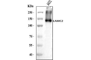 Western blot analysis of LAMC2 using anti-LAMC2 antibody (ABIN7600314).