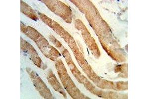 IHC analysis of FFPE human skeletal muscle stained with RAB7 antibody (RAB7A Antikörper  (AA 176-204))