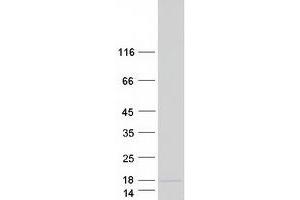 CAMK2N2 Protein (Myc-DYKDDDDK Tag)