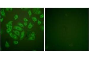 Immunofluorescence (IF) image for anti-Cystatin A (Stefin A) (CSTA) (AA 49-98) antibody (ABIN2879130) (CSTA Antikörper  (AA 49-98))