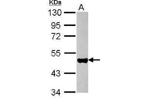 WB Image Sample (30 ug of whole cell lysate) A: HeLa 10% SDS PAGE antibody diluted at 1:10000 (KRT17 Antikörper)