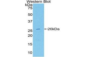 Western Blotting (WB) image for anti-Deoxyribonuclease I-Like 2 (DNASE1L2) (AA 32-229) antibody (ABIN3209086) (DNASE1L2 Antikörper  (AA 32-229))