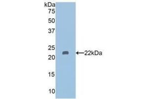 Detection of Recombinant HDAC6, Human using Polyclonal Antibody to Histone Deacetylase 6 (HDAC6) (HDAC6 Antikörper  (AA 166-348))